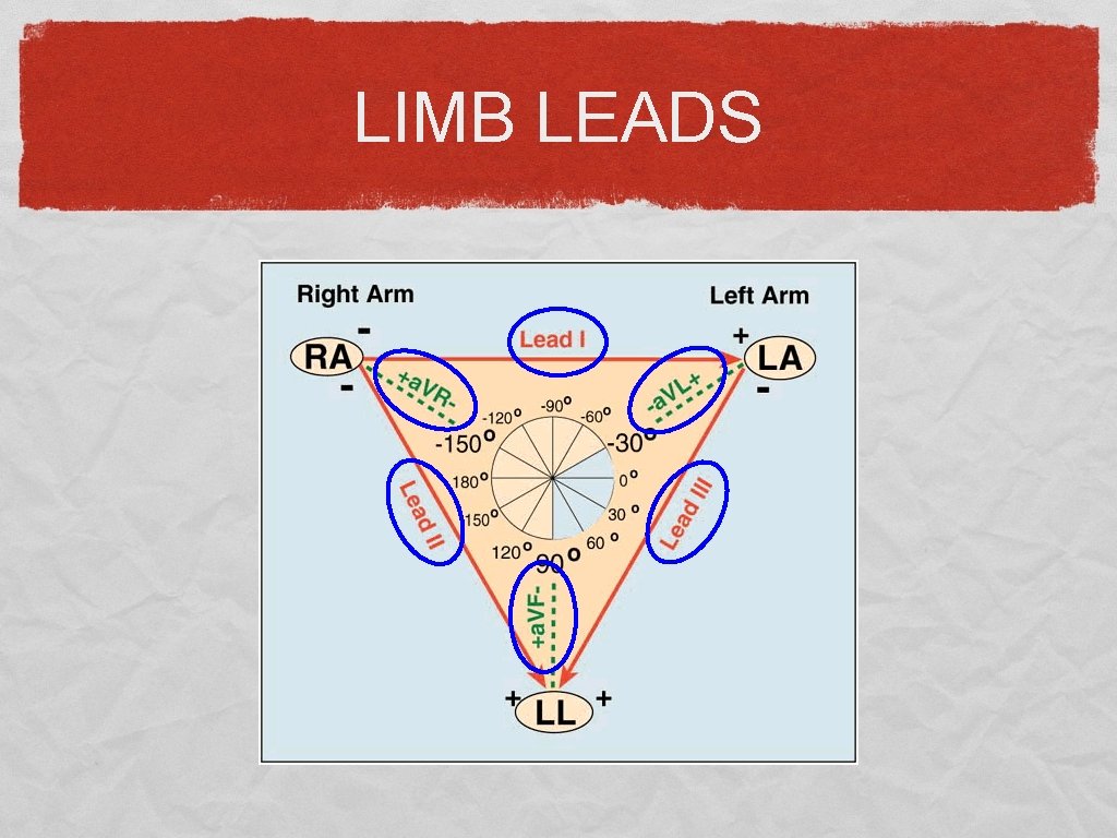 LIMB LEADS 