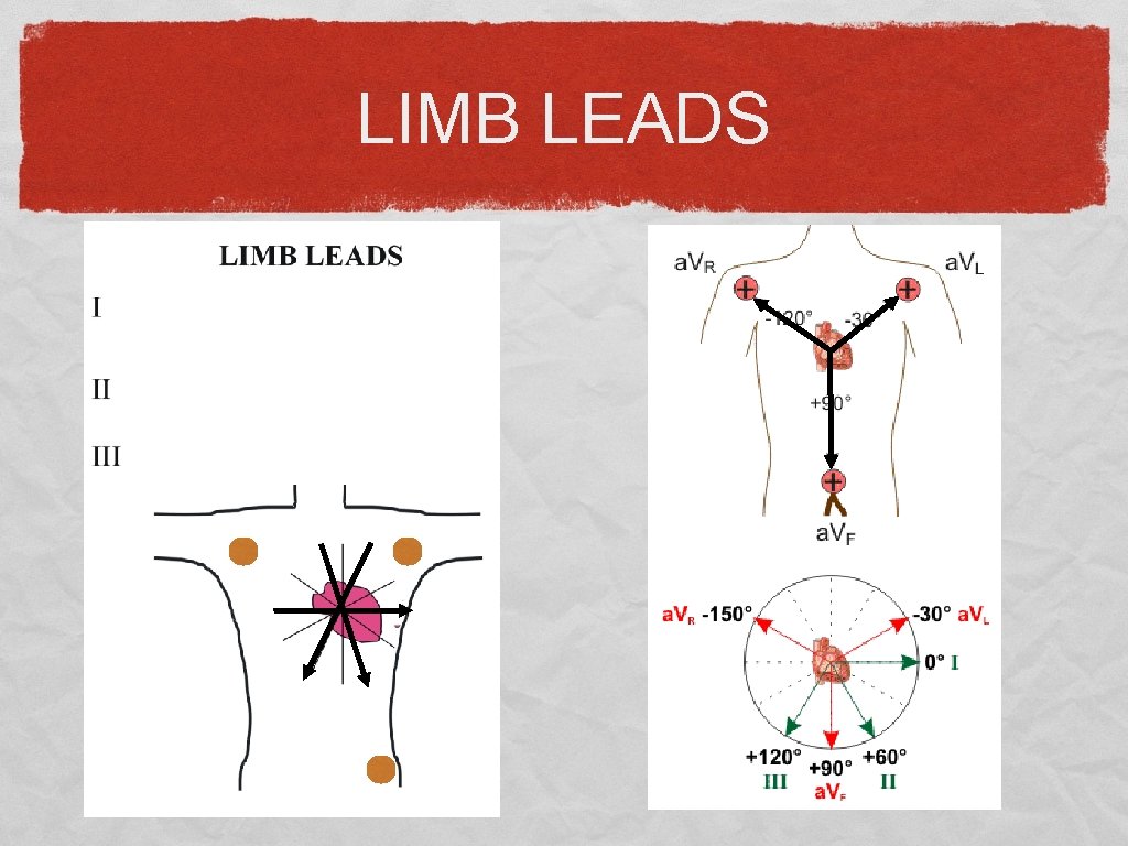 LIMB LEADS 