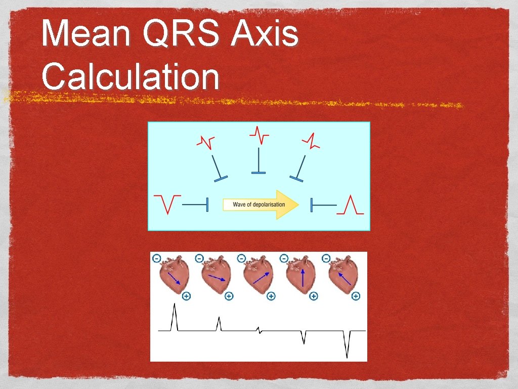 Mean QRS Axis Calculation 