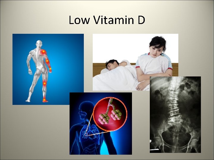 Low Vitamin D 