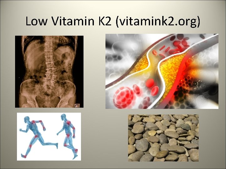 Low Vitamin K 2 (vitamink 2. org) 