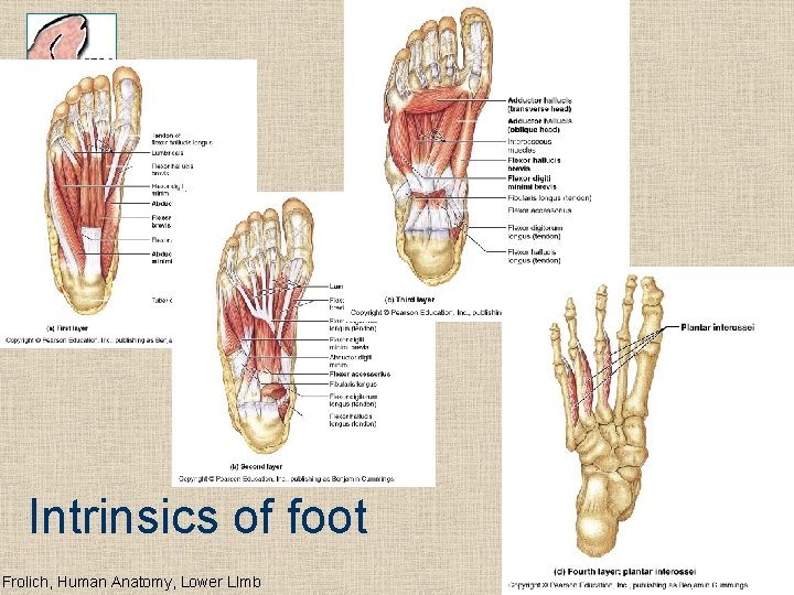 Intrinsics of foot Frolich, Human Anatomy, Lower LImb 