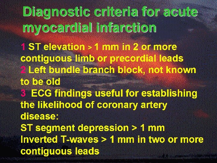 Diagnostic criteria for acute myocardial infarction 1 ST elevation > 1 mm in 2