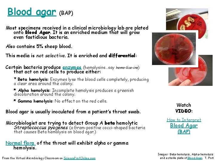 Blood agar (BAP) Most specimens received in a clinical microbiology lab are plated onto