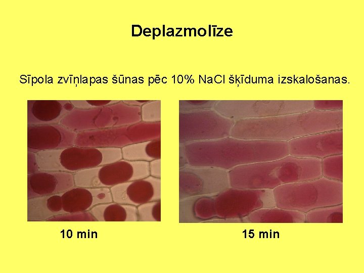 Deplazmolīze Sīpola zvīņlapas šūnas pēc 10% Na. Cl šķīduma izskalošanas. 10 min 15 min