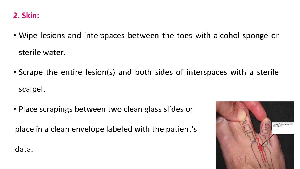 2. Skin: • Wipe lesions and interspaces between the toes with alcohol sponge or