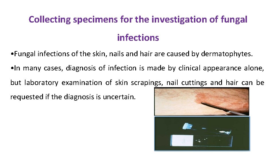 Collecting specimens for the investigation of fungal infections • Fungal infections of the skin,