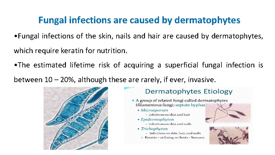 Fungal infections are caused by dermatophytes • Fungal infections of the skin, nails and
