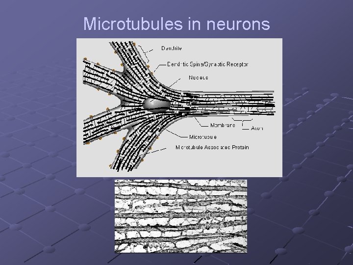 Microtubules in neurons 