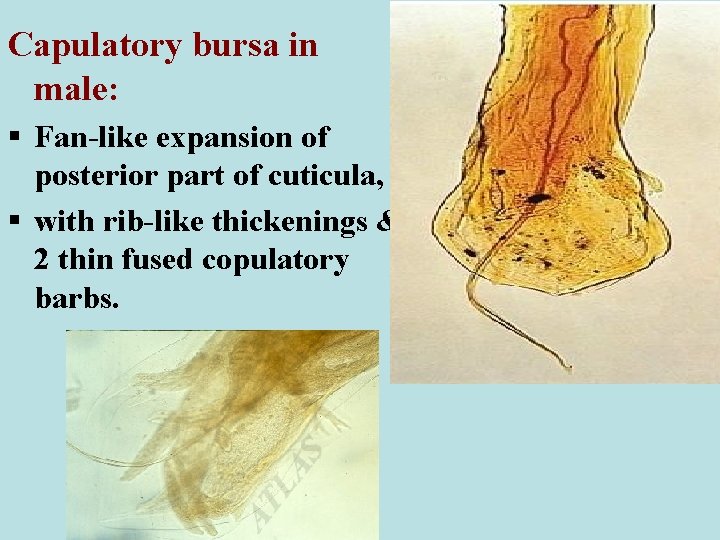 Capulatory bursa in male: § Fan-like expansion of posterior part of cuticula, § with