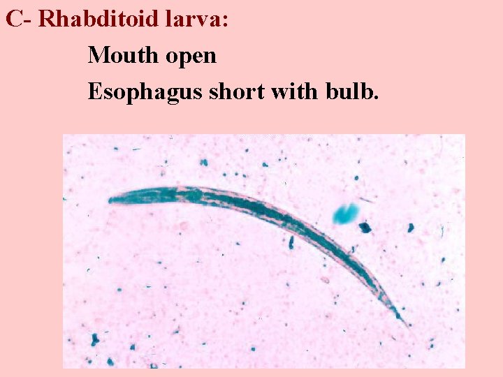 C- Rhabditoid larva: Mouth open Esophagus short with bulb. 