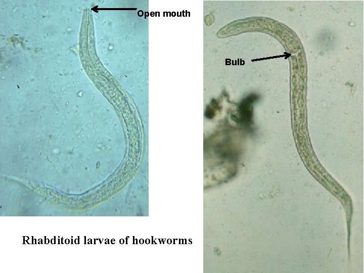 Open mouth Bulb Rhabditoid larvae of hookworms 