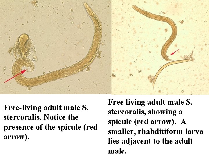 Free-living adult male S. stercoralis. Notice the presence of the spicule (red arrow). Free