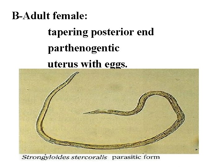 B-Adult female: tapering posterior end parthenogentic uterus with eggs. 
