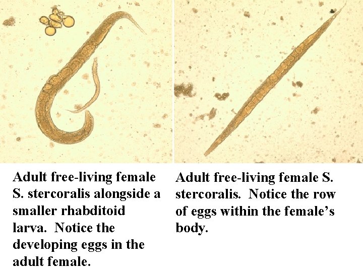 Adult free-living female S. stercoralis alongside a smaller rhabditoid larva. Notice the developing eggs