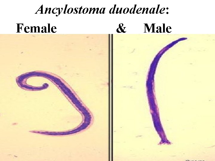 Ancylostoma duodenale: Female & Male 