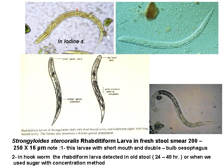In Iodine s. Strongyloides stercoralis Rhabditiform Larva in fresh stool smear 200 – 250