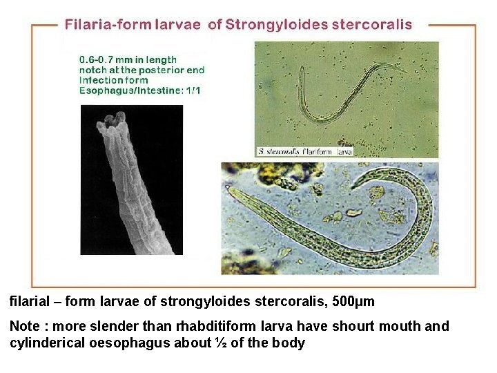 filarial – form larvae of strongyloides stercoralis, 500µm Note : more slender than rhabditiform