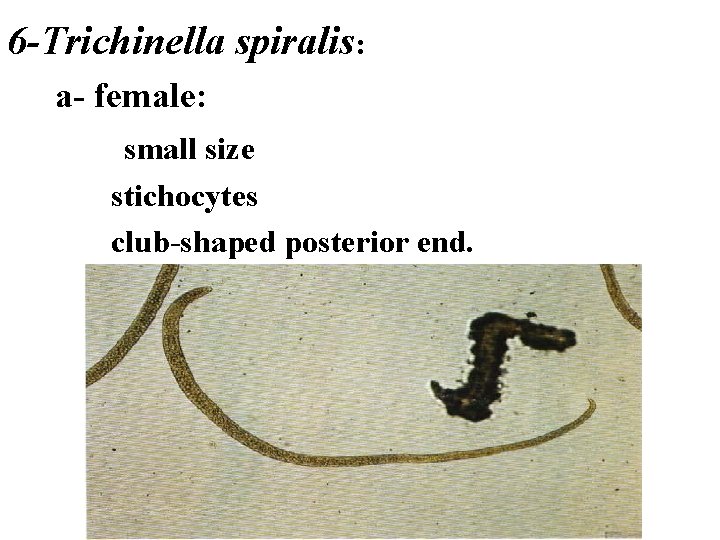 6 -Trichinella spiralis: a- female: small size stichocytes club-shaped posterior end. 