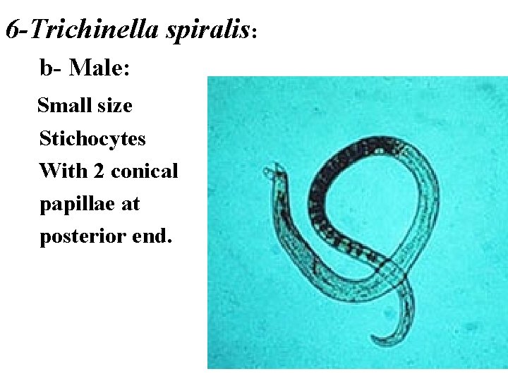 6 -Trichinella spiralis: b- Male: Small size Stichocytes With 2 conical papillae at posterior