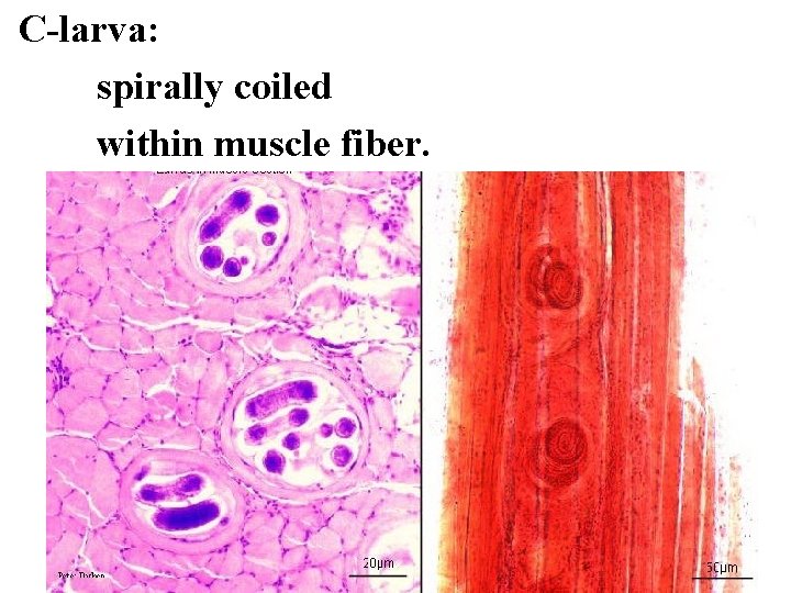 C-larva: spirally coiled within muscle fiber. 