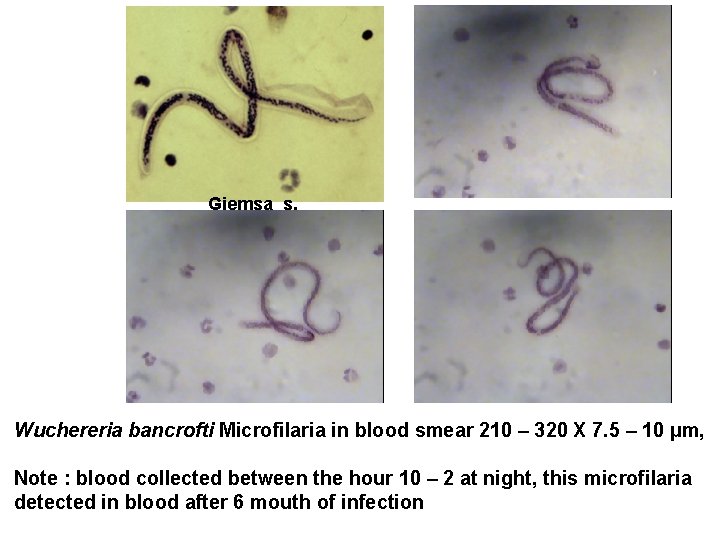 Giemsa s. Wuchereria bancrofti Microfilaria in blood smear 210 – 320 X 7. 5