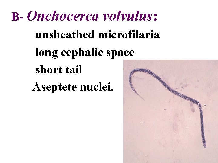 B- Onchocerca volvulus: unsheathed microfilaria long cephalic space short tail Aseptete nuclei. 