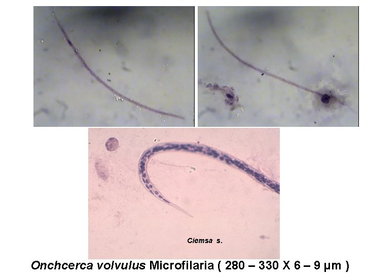 Ciemsa s. Onchcerca volvulus Microfilaria ( 280 – 330 X 6 – 9 µm