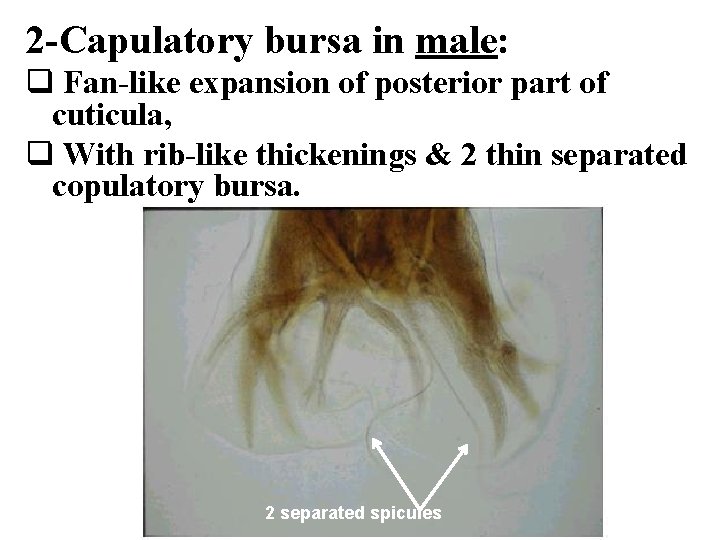 2 -Capulatory bursa in male: q Fan-like expansion of posterior part of cuticula, q