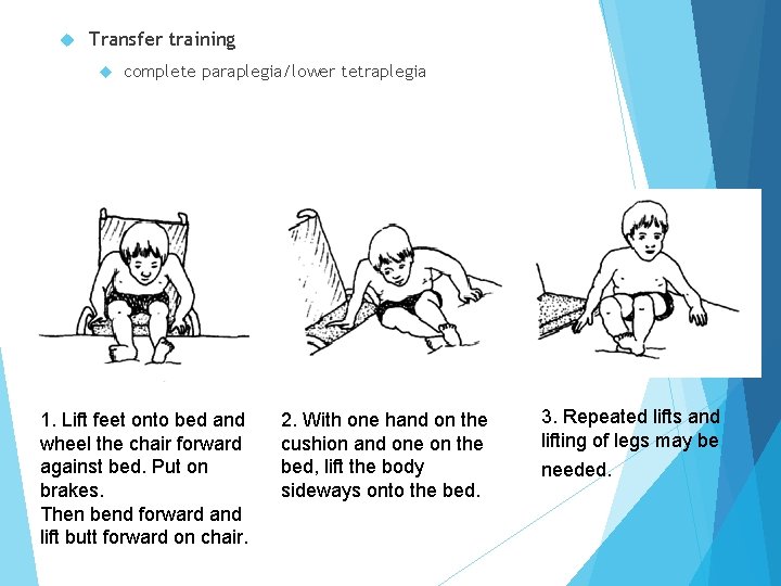  Transfer training complete paraplegia/lower tetraplegia 1. Lift feet onto bed and wheel the