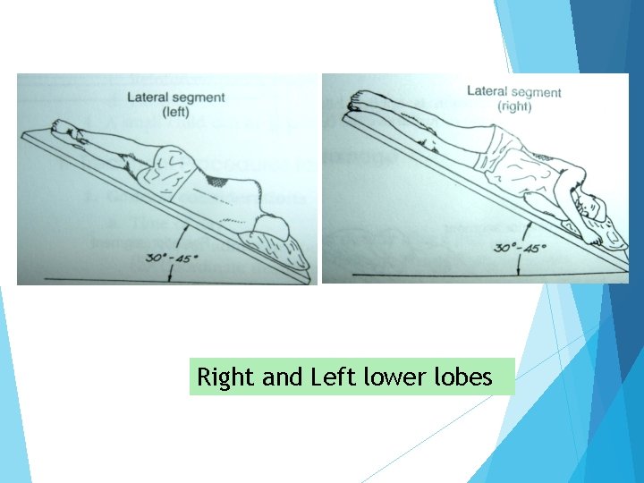 Right and Left lower lobes 