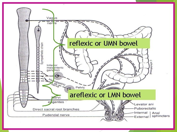 reflexic or UMN bowel areflexic or LMN bowel 