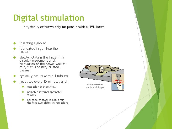 Digital stimulation * typically effective only for people with a UMN bowel Inserting a