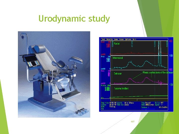 Urodynamic study 107 