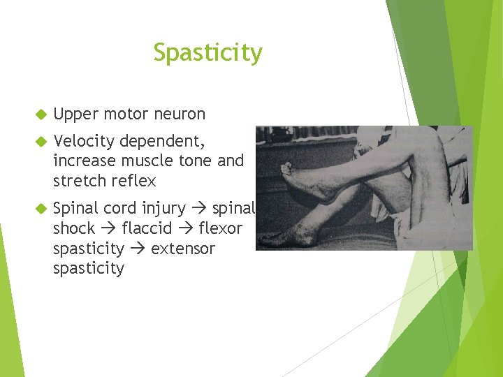 Spasticity Upper motor neuron Velocity dependent, increase muscle tone and stretch reflex Spinal cord