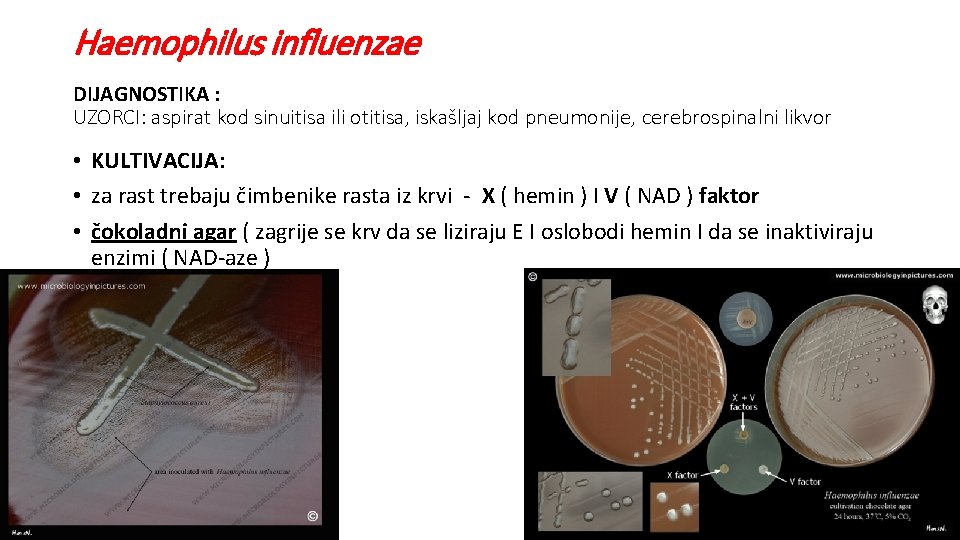 Haemophilus influenzae DIJAGNOSTIKA : UZORCI: aspirat kod sinuitisa ili otitisa, iskašljaj kod pneumonije, cerebrospinalni