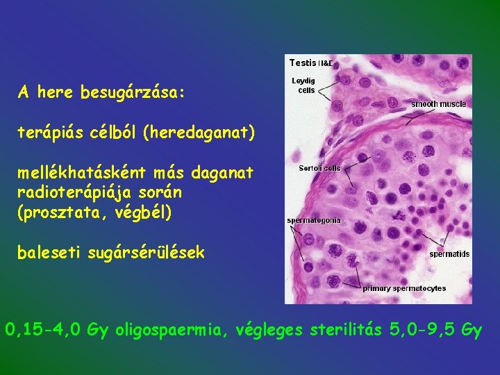 A here besugárzása: terápiás célból (heredaganat) mellékhatásként más daganat radioterápiája során (prosztata, végbél) baleseti