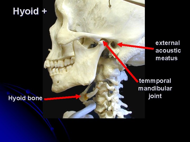 Hyoid + external acoustic meatus Hyoid bone temmporal mandibular joint 