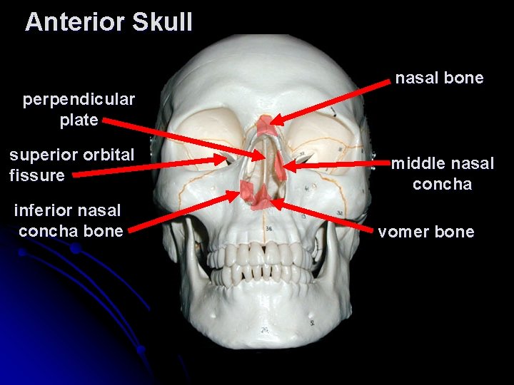 Anterior Skull nasal bone perpendicular plate superior orbital fissure inferior nasal concha bone middle