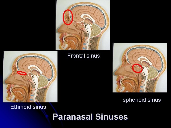 Frontal sinus sphenoid sinus Ethmoid sinus Paranasal Sinuses 