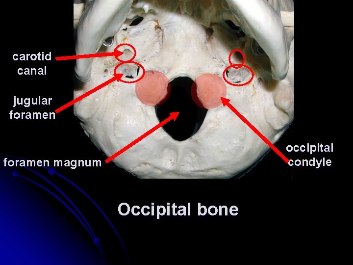 carotid canal jugular foramen occipital condyle foramen magnum Occipital bone 