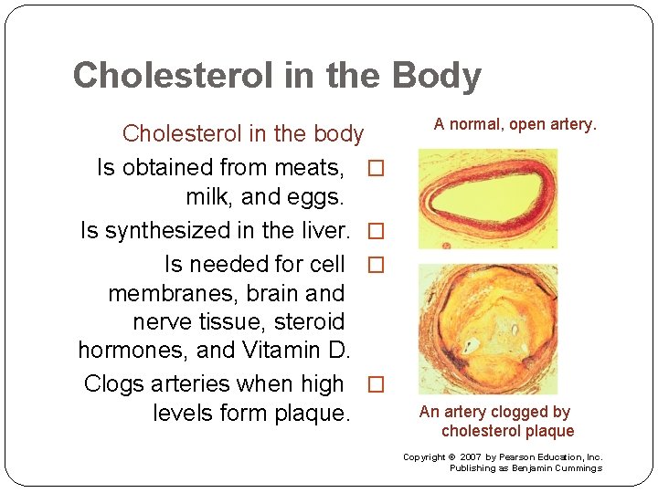 Cholesterol in the Body Cholesterol in the body Is obtained from meats, � milk,