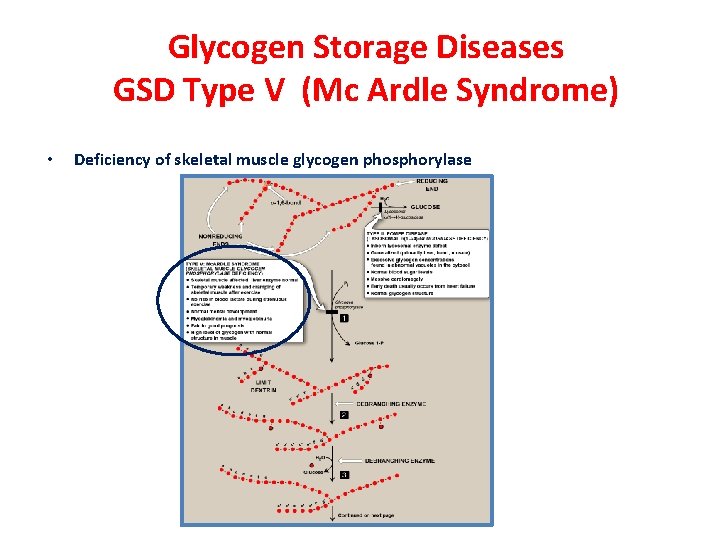 Glycogen Storage Diseases GSD Type V (Mc Ardle Syndrome) • Deficiency of skeletal muscle