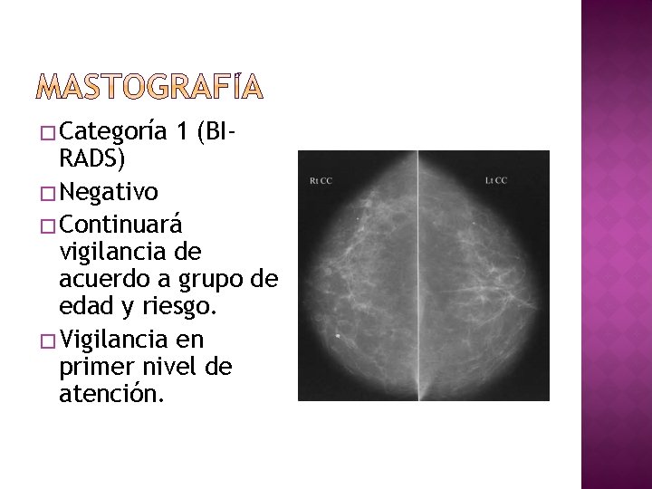 � Categoría 1 (BI- RADS) � Negativo � Continuará vigilancia de acuerdo a grupo