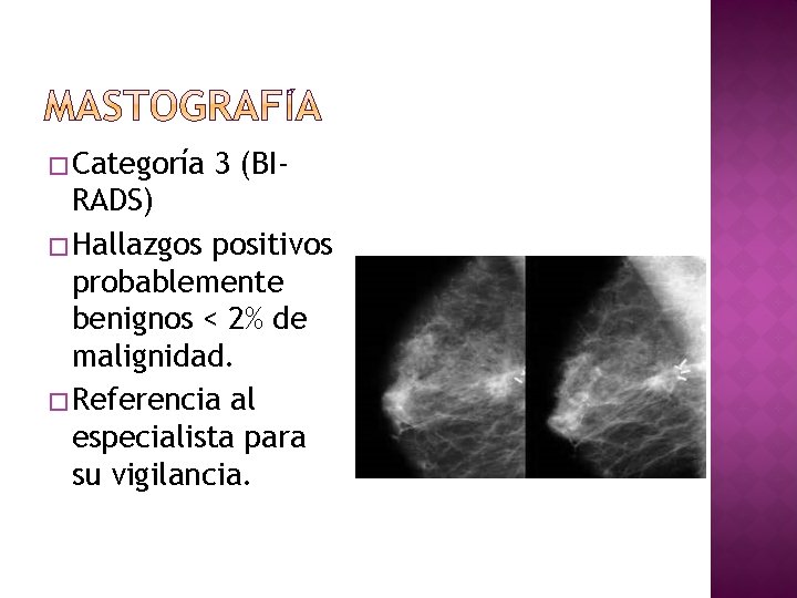 � Categoría 3 (BI- RADS) � Hallazgos positivos probablemente benignos < 2% de malignidad.