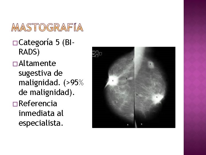 � Categoría 5 (BI- RADS) � Altamente sugestiva de malignidad. (>95% de malignidad). �