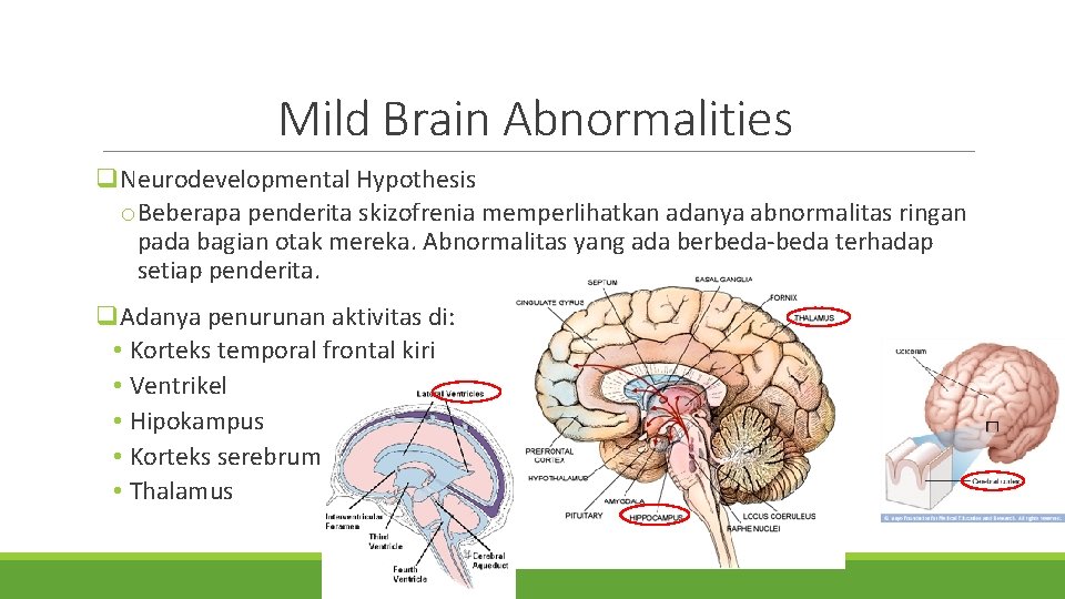 Mild Brain Abnormalities q. Neurodevelopmental Hypothesis o. Beberapa penderita skizofrenia memperlihatkan adanya abnormalitas ringan