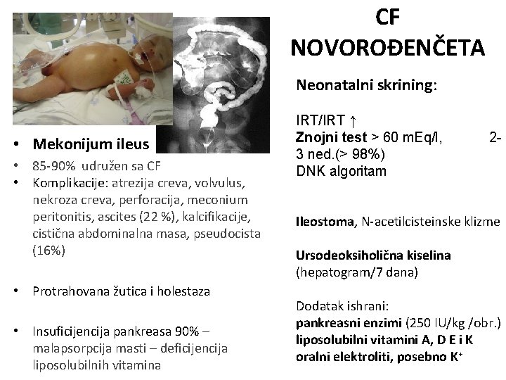 CF NOVOROĐENČETA Neonatalni skrining: • Mekonijum ileus • 85 -90% udružen sa CF •