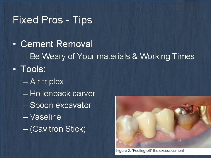 Fixed Pros - Tips • Cement Removal – Be Weary of Your materials &