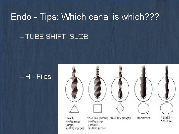 Endo - Tips: Which canal is which? ? ? – TUBE SHIFT: SLOB –